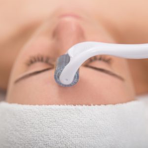 Face microneedling treatment with a meso roller.